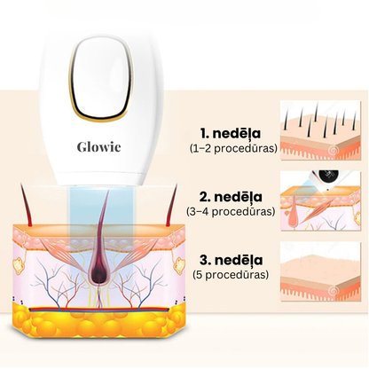 Glowie™ matiņu noņemšanas komplekts