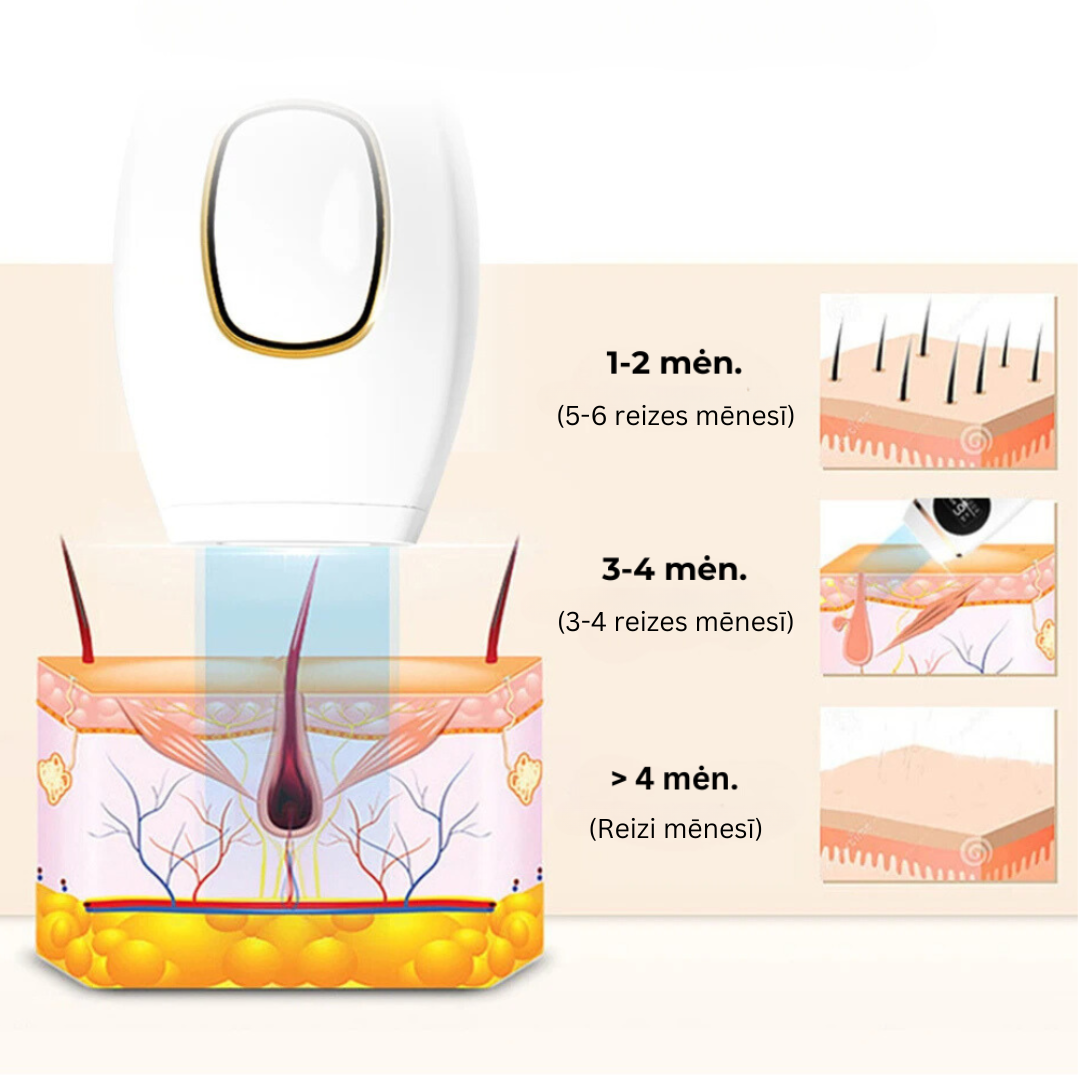 Glowie™ IPL fotoepilators – matu noņemšanas ierīce