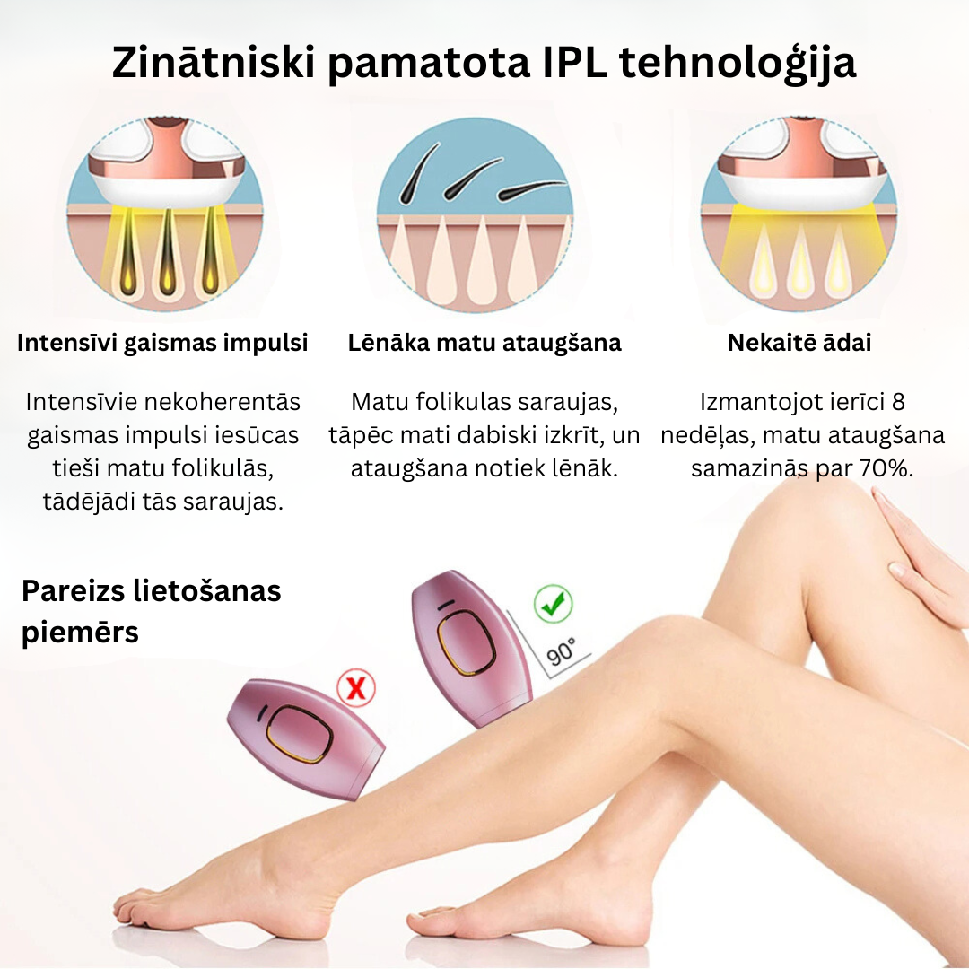 Glowie™ IPL fotoepilators – matu noņemšanas ierīce