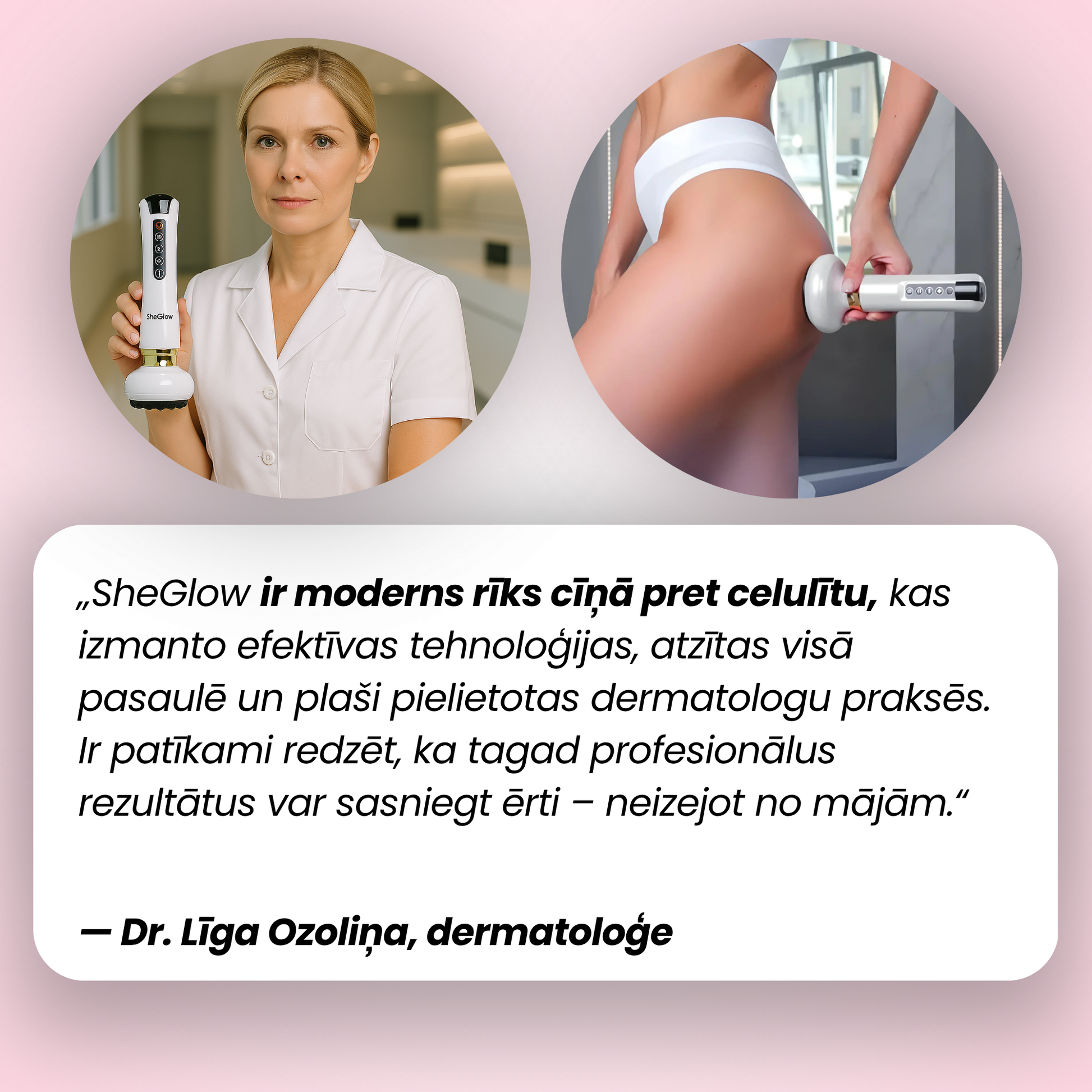 Dermatologa ieteikums: SheGlow pretcelulīta ierīce profesionāliem rezultātiem mājas apstākļos